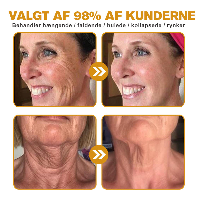 🍎💎Fremstillet og afsendt fra Danmark✅Furzero™ Botox Bi-Venom Rynkefjerningscreme – Sidste dags kampagne: Spar 70%