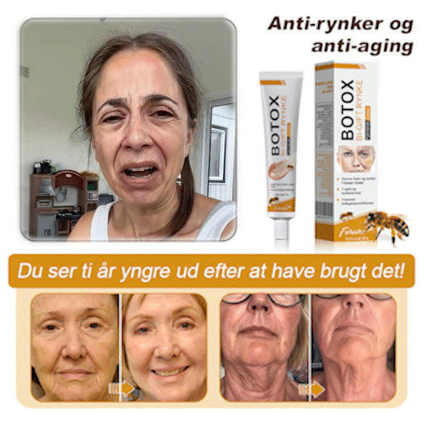 🍎💎Fremstillet og afsendt fra Danmark✅Furzero™ Botox Bi-Venom Rynkefjerningscreme – Sidste dags kampagne: Spar 70%