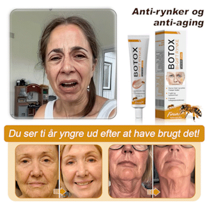 🍎💎Fremstillet og afsendt fra Danmark✅Furzero™ Botox Bi-Venom Rynkefjerningscreme – Sidste dags kampagne: Spar 70%