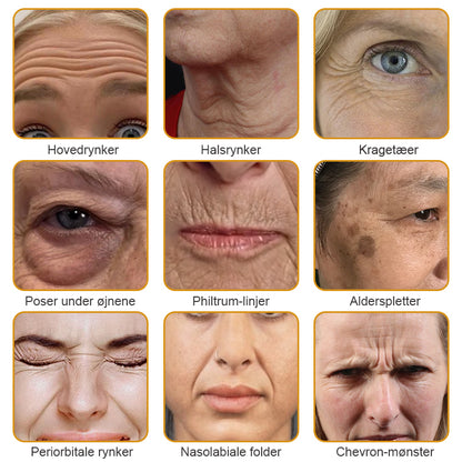 🍎💎Fremstillet og afsendt fra Danmark✅Furzero™ Botox Bi-Venom Rynkefjerningscreme – Sidste dags kampagne: Spar 70%